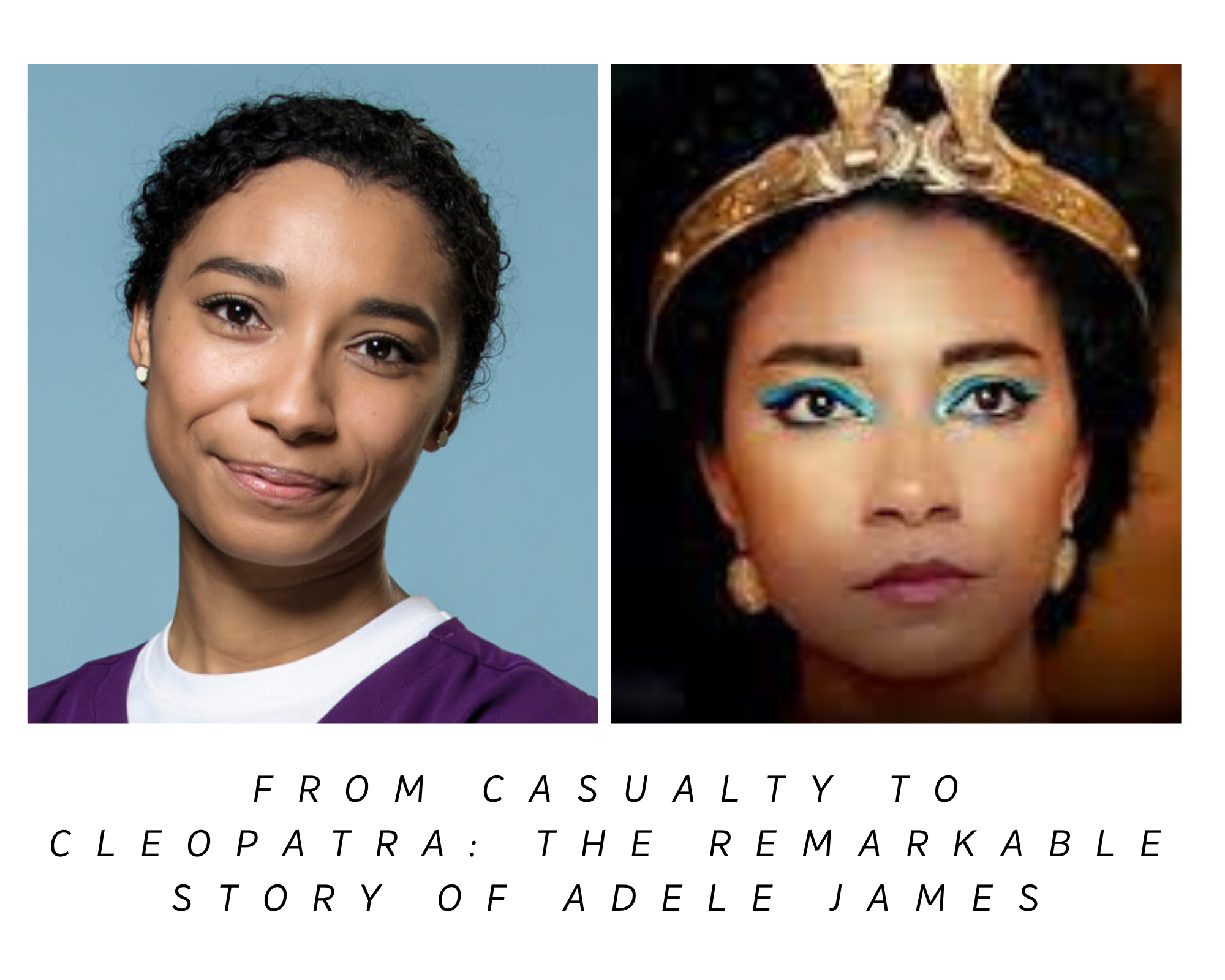 Unveiling Adele James: A Journey from Casualty to Cleopatra